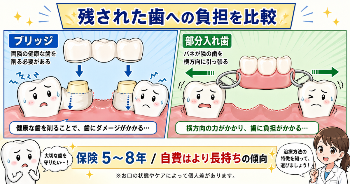 入れ歯とブリッジを徹底比較！仕事（会話）や食事へのリアルな影響