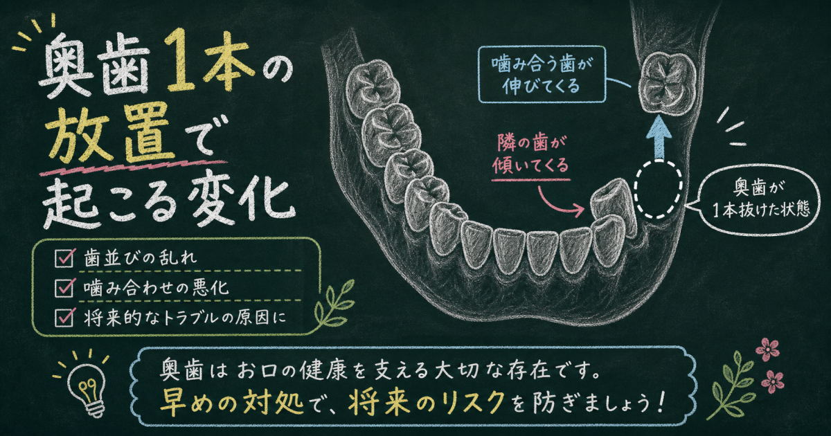 奥歯が1本ないまま放置する影響は?起こりうる変化と治療法を解説