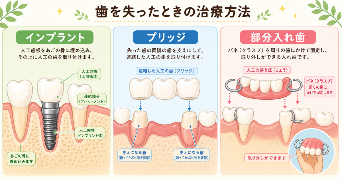 すぐに通院できない場合の応急処置と、お口を守るセルフケアの注意点