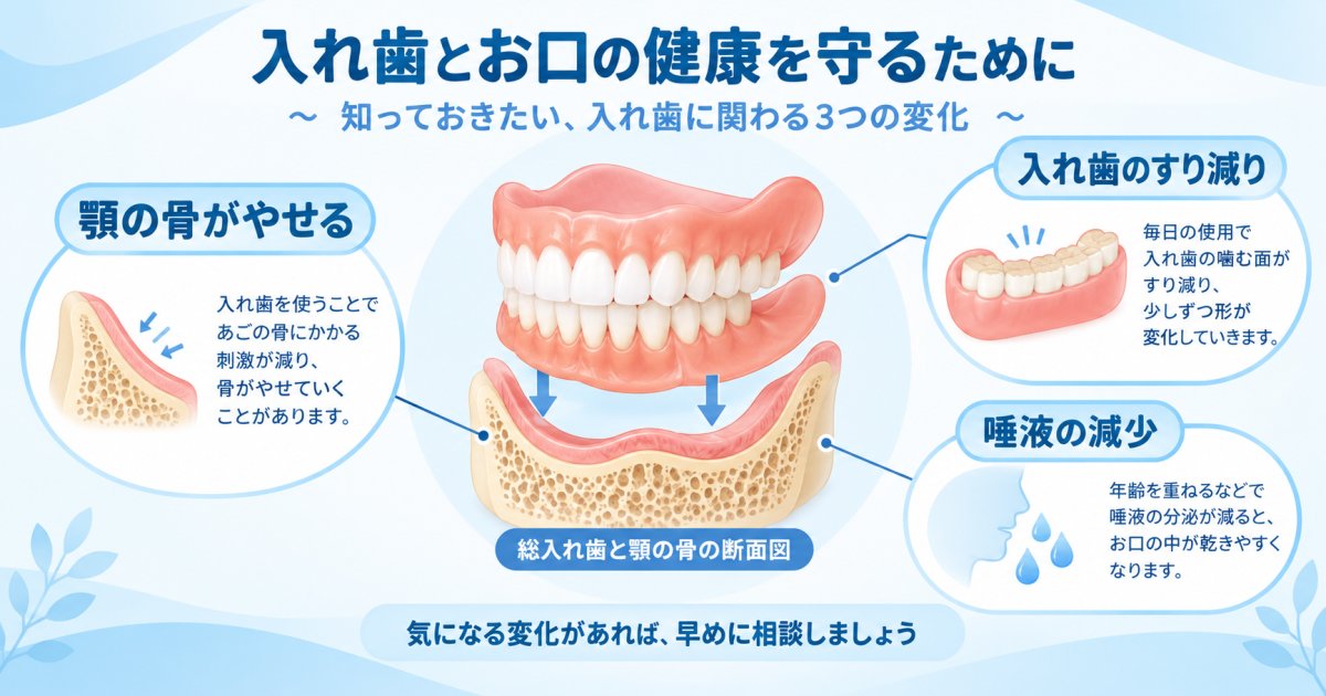入れ歯が合わなくなる主な原因—歯ぐき・骨・噛み合わせの変化
