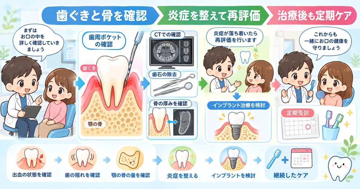 歯周病がある場合のインプラント治療条件と歯茎の評価基準